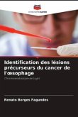 Identification des lésions précurseurs du cancer de l'¿sophage