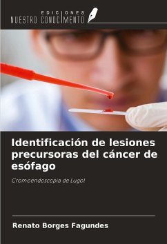 Identificación de lesiones precursoras del cáncer de esófago Cover Identificación de lesiones precursoras del cáncer de esófago