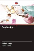 Exodontie