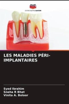 LES MALADIES PÉRI-IMPLANTAIRES - Ibrahim, Syed;Bhat, Sneha R;Boloor, Vinita A.