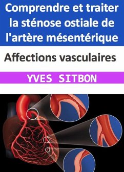 Affections vasculaires : Comprendre et traiter la sténose ostiale de l'artère mésentérique (eBook, ePUB) - Sitbon, Yves