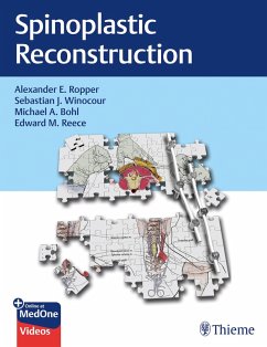 Cover Spinoplastic Reconstruction (eBook, ePUB)