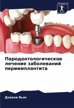 Cover Parodontologicheskoe lechenie zabolewanij periimplantita