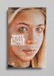 White Lives Matter - Bild 1