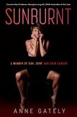 SUNBURNT (eBook, ePUB)