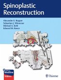 Spinoplastic Reconstruction (eBook, PDF)