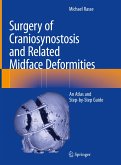 Surgery of Craniosynostosis and Related Midface Deformities (eBook, PDF)