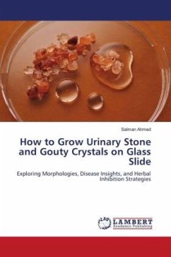 How to Grow Urinary Stone and Gouty Crystals on Glass Slide - Ahmed, Salman