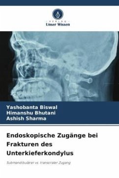 Endoskopische Zugänge bei Frakturen des Unterkieferkondylus - Biswal, Yashobanta;Bhutani, Himanshu;Sharma, Ashish