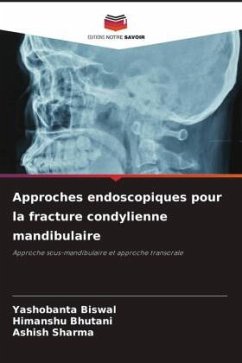 Approches endoscopiques pour la fracture condylienne mandibulaire - Biswal, Yashobanta;Bhutani, Himanshu;Sharma, Ashish