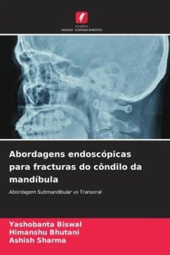 Abordagens endoscópicas para fracturas do côndilo da mandíbula - Biswal, Yashobanta;Bhutani, Himanshu;Sharma, Ashish