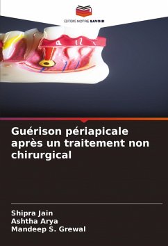 Guérison périapicale après un traitement non chirurgical - Jain, Shipra;Arya, Ashtha;Grewal, Mandeep S.