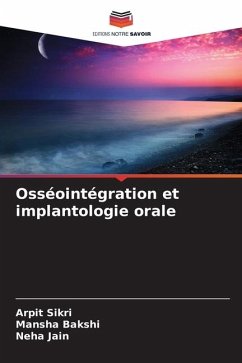 Osséointégration et implantologie orale - Sikri, Arpit;Bakshi, Mansha;Jain, Neha