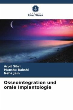 Osseointegration und orale Implantologie - Sikri, Arpit;Bakshi, Mansha;Jain, Neha