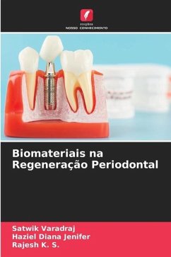 Biomateriais na Regeneração Periodontal - Varadraj, Satwik;Jenifer, Haziel Diana;K. S., Rajesh