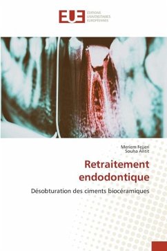 Retraitement endodontique - Fejjeri, Meriem;Antit, Souha