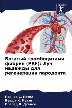 Bogatyj trombocitami fibrin (PRF): Luch nadezhdy dlq regeneracii parodonta - Patil, Pranaw S.;K. Kuazi, Bushra;Dhadse, Prasad V.