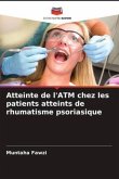 Atteinte de l'ATM chez les patients atteints de rhumatisme psoriasique