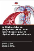 La fibrine riche en plaquettes (PRF) : Une lueur d'espoir pour la régénération parodontale