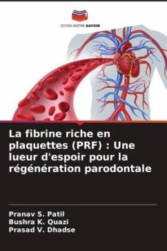 La fibrine riche en plaquettes (PRF) : Une lueur d'espoir pour la régénération parodontale - Patil, Pranav S.;K. Quazi, Bushra;Dhadse, Prasad V.