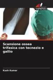 Scansione ossea trifasica con tecnezio e gallio