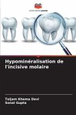 Hypominéralisation de l'incisive molaire