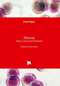 Abscess - Types, Causes and Treatment