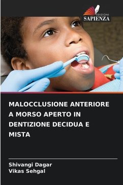 MALOCCLUSIONE ANTERIORE A MORSO APERTO IN DENTIZIONE DECIDUA E MISTA - Dagar, Shivangi;Sehgal, Vikas