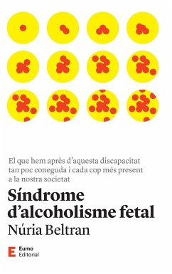 Síndrome d'alcoholisme fetal