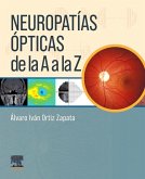 Neuropatías ópticas de la A a la Z Neuropatías ópticas de la A a la Z
