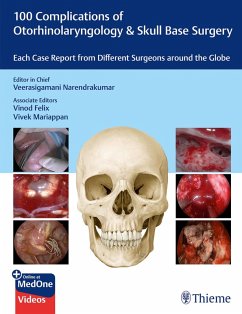 Cover 100 Complications of Otorhinolaryngology & Skull Base Surgery (eBook, ePUB)