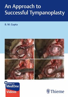 An Approach to Successful Tympanoplasty - Gupta, B