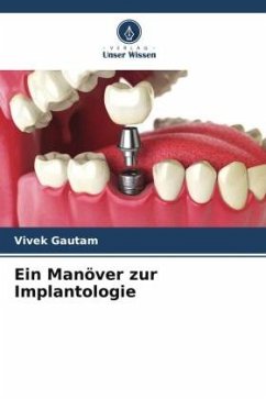 Ein Manöver zur Implantologie - Gautam, Vivek