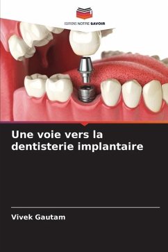 Une voie vers la dentisterie implantaire - Gautam, Vivek