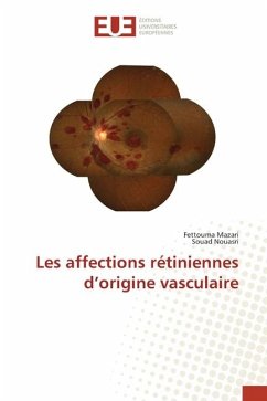 Les affections rétiniennes d¿origine vasculaire - Mazari, Fettouma;Nouasri, Souad