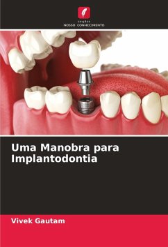 Uma Manobra para Implantodontia Cover Uma Manobra para Implantodontia