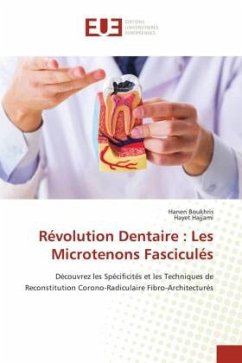 Révolution Dentaire : Les Microtenons Fasciculés - Boukhris, Hanen;Hajjami, Hayet