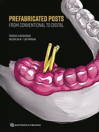 Prefabricated Posts