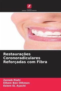 Restaurações Coronoradiculares Reforçadas com Fibra - Riahi, Zeineb;Ben Othmen, Elhem;EL Ayachi, Eslem