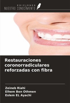 Cover Restauraciones coronorradiculares reforzadas con fibra