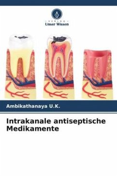 Intrakanale antiseptische Medikamente - U.K., Ambikathanaya