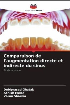 Comparaison de l'augmentation directe et indirecte du sinus - Ghatak, Debiprasad;Mular, Ashish;Sharma, Varun