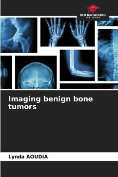 Imaging benign bone tumors - Aoudia, Lynda