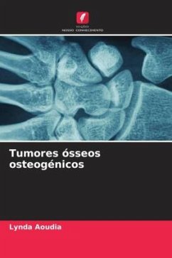 Tumores ósseos osteogénicos - Aoudia, Lynda