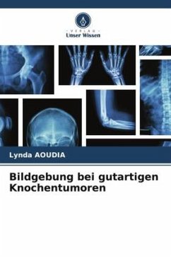 Bildgebung bei gutartigen Knochentumoren - Aoudia, Lynda