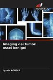 Imaging dei tumori ossei benigni