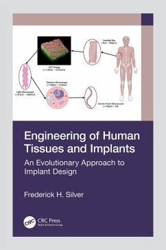 Engineering of Human Tissues and Implants (eBook, ePUB) - Silver, Frederick H.