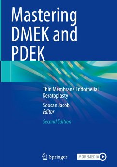 Cover Mastering DMEK and PDEK