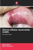 Úlcera aftosa recorrente (UAR)