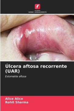 Úlcera aftosa recorrente (UAR) - Alice, Alice;Sharma, Rohit